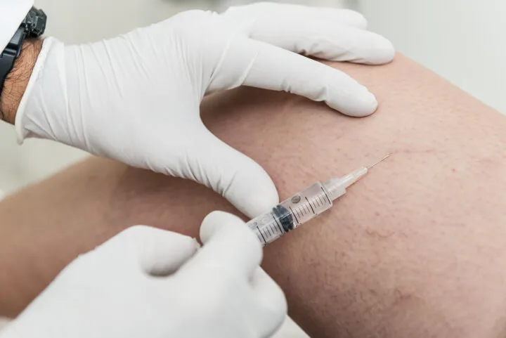 How Many Injections Does It Take to Get Rid of Spider Veins?
