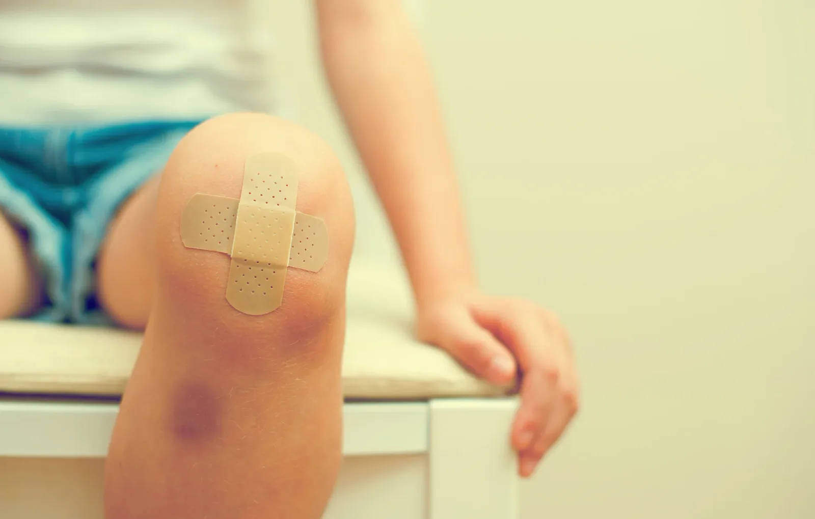 Can Chronic Venous Insufficiency Cause Bruising?