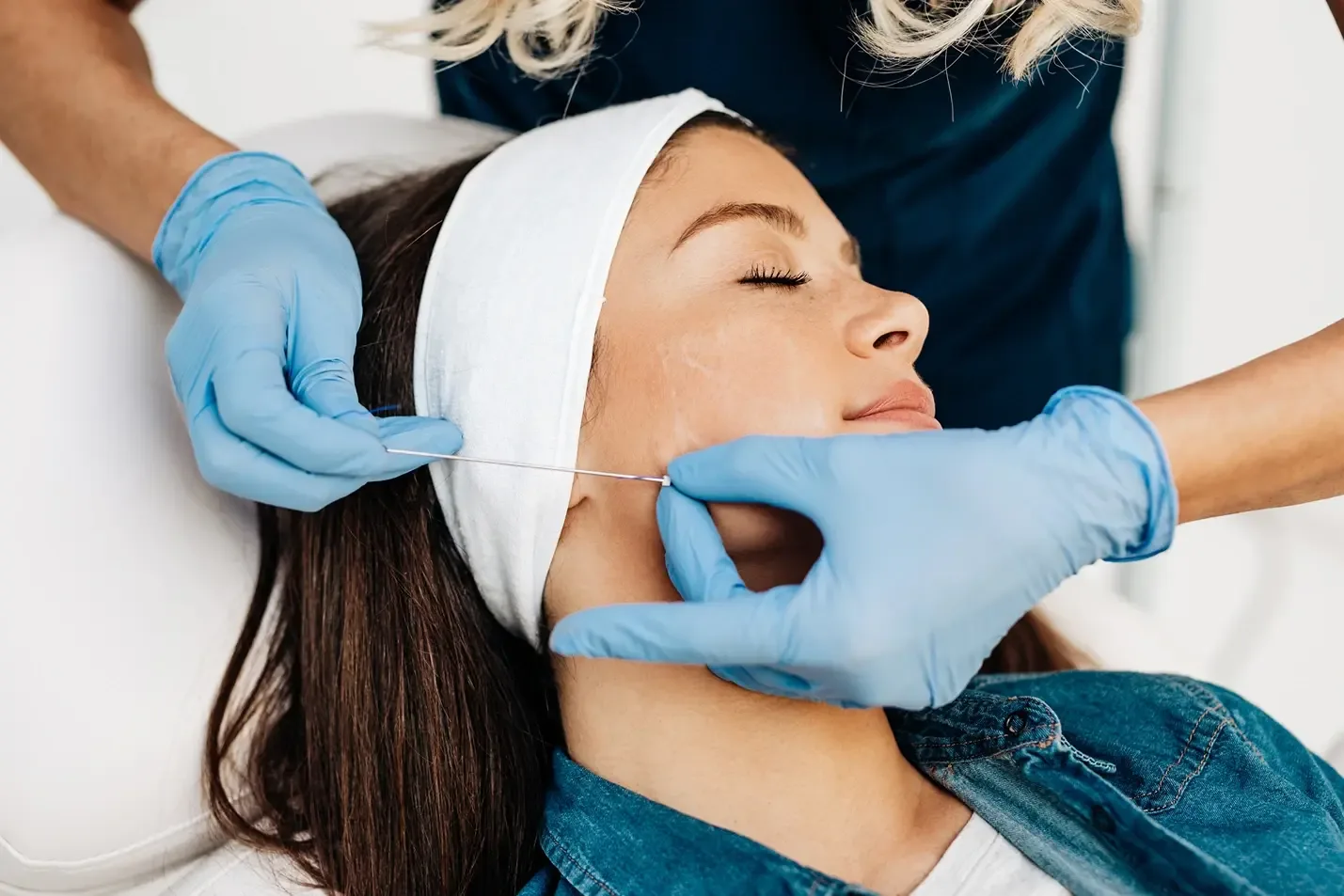 Electrolysis for Facial Thread Veins: What You Need to Know