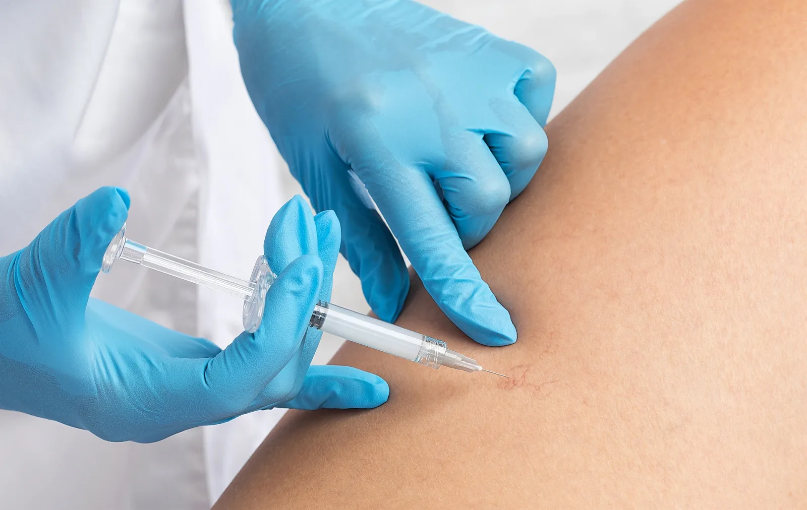 Should I Get Treatment for Chronic Venous Insufficiency?