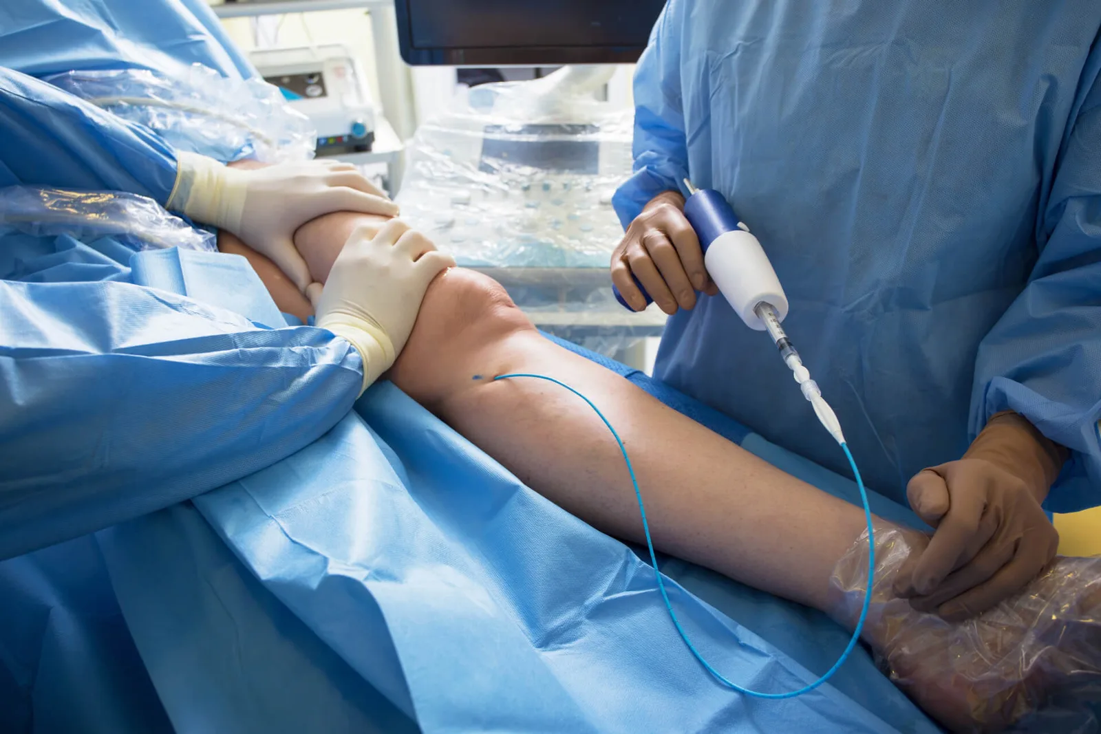 What Are the Options For Varicose Vein Surgery?